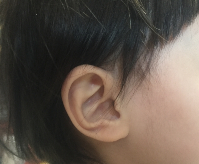 幼児の耳掃除は耳鼻科で 長男 次男を耳鼻科に連れて行きました ずぼらっこ